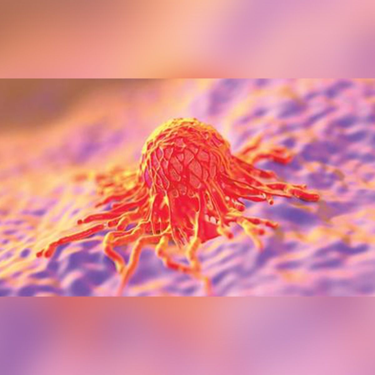 Image of an ovarian cancer cell