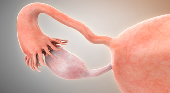 Bevacizumab With Olaparib Extends Time to Toxicity in Patients With Newly Diagnosed Ovarian Cancer 