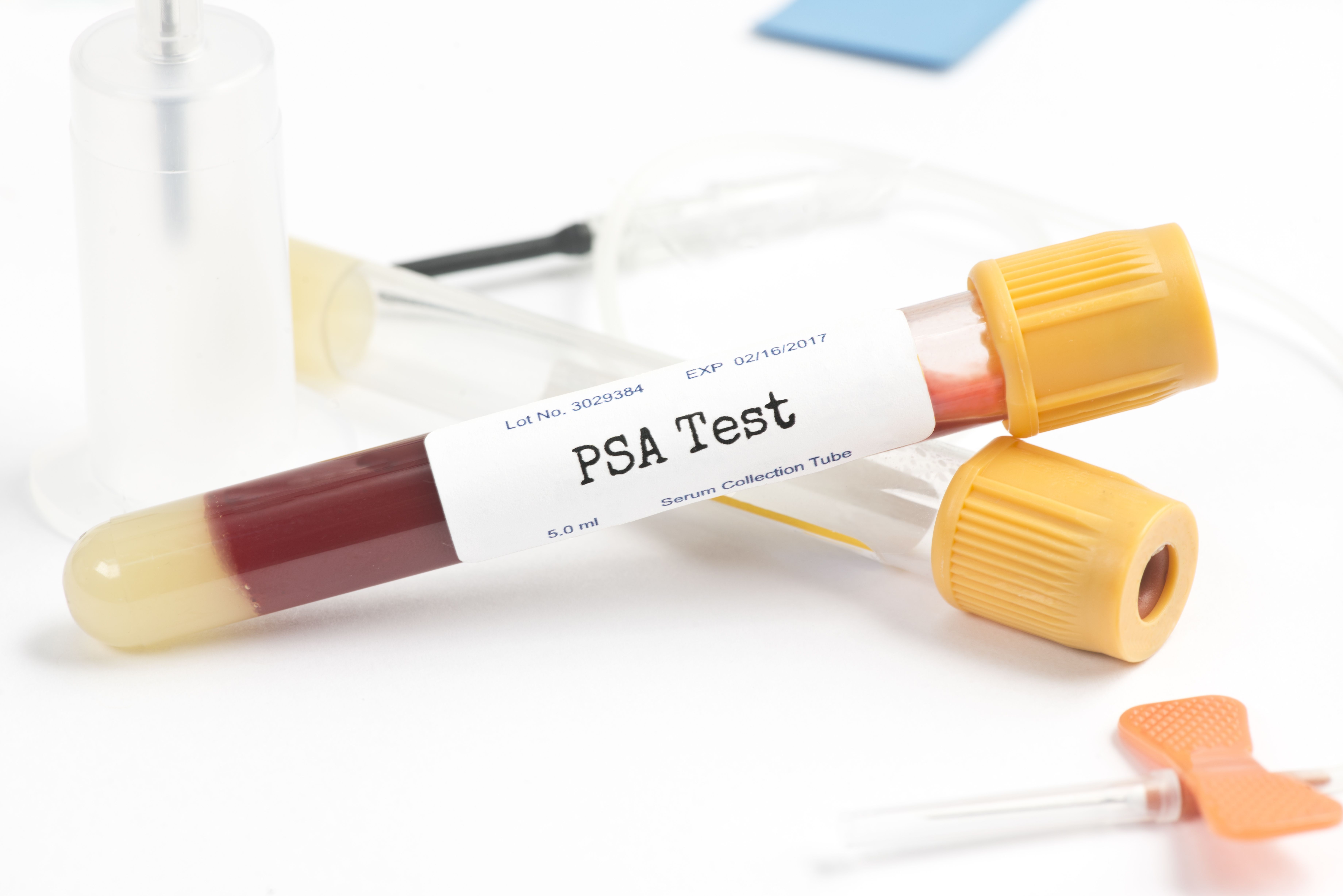 Do You Need To Fast Before A Psa Lab Test