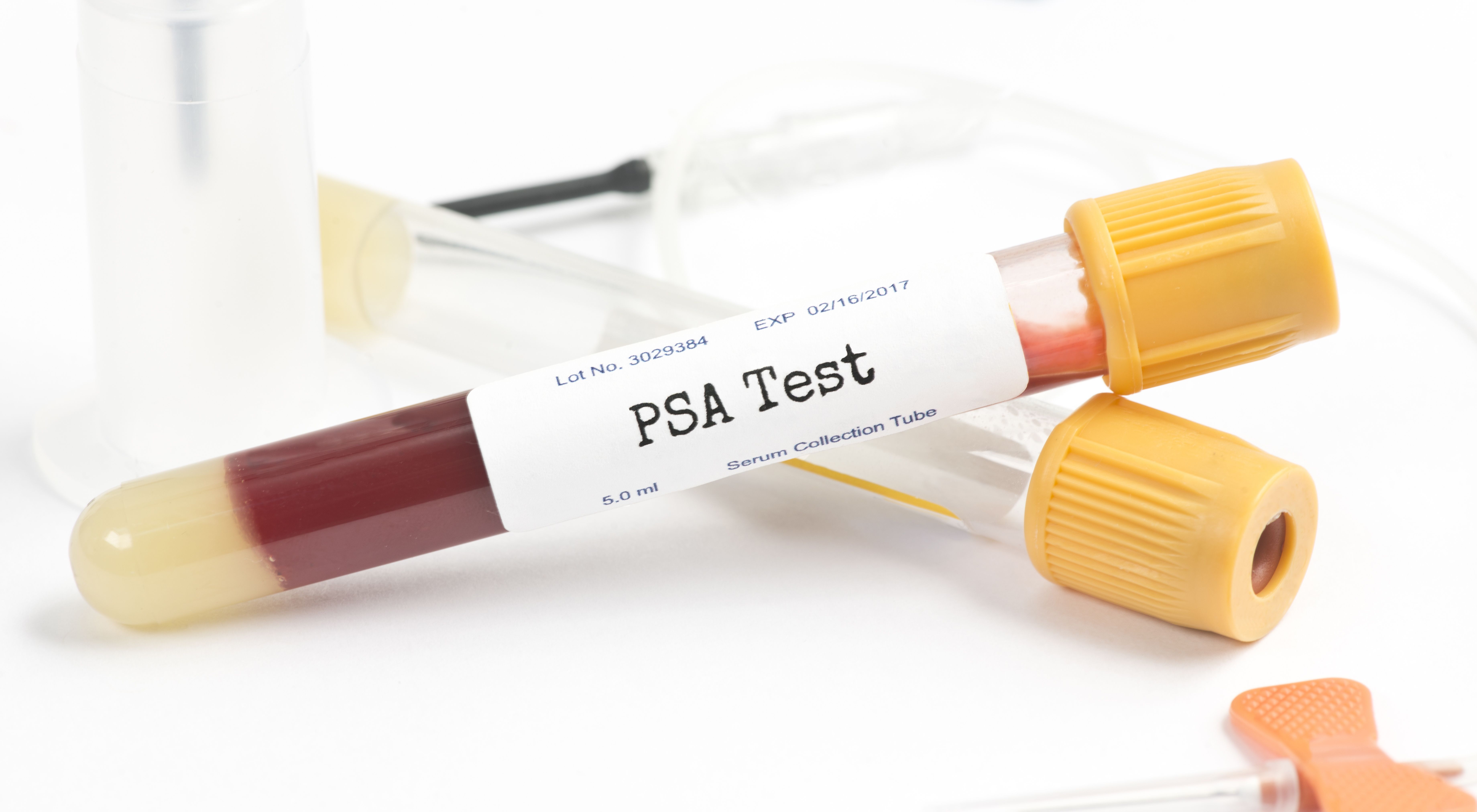 Psa. Тест на пса. PSA Test. Озанимод препарат. Anifrolumab.