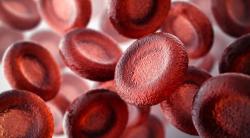 5-Year Follow-Up Suggests Luspatercept Safely Reduces Anemia in Patients With Lower-Risk Myelodysplastic Syndromes
