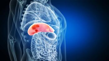 Graphic of a liver with tumors