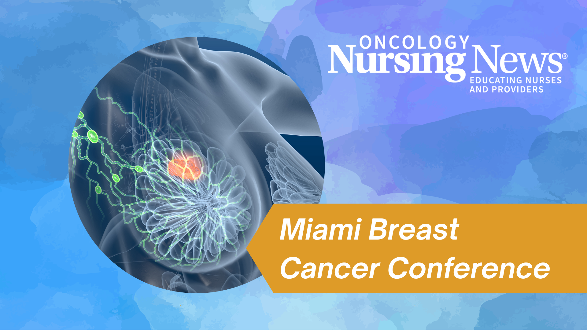 Graphic with an image of a breast with a tumor, a banner that reads "Miami Breast Cancer Conference," and an Oncology Nursing News logo