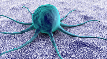 Avelumab/Axitinib Combo May Unlock New Treatment Direction for Rare Thymic Epithelial Tumors 