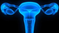 Adding Bevacizumab to Pembrolizumab Enhances Response Rates in Epithelial Ovarian Cancer