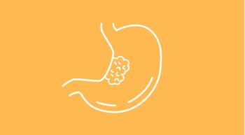 Esophagogastric Cancer