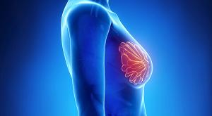 Managing Adverse Events in Patients Taking Abemaciclib