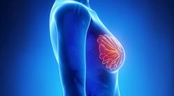 Olaparib Is Beneficial 1 Year After Standard of Care Therapies in BRCA, High-Risk, Early HER2- Breast Cancer