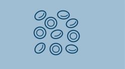 Zanubrutinib Outperforms Ibrutinib in Head-to-Head Trial for Relapsed/Refractory CLL/SLL