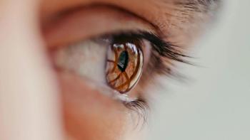 image of an eye
