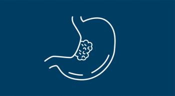 Advanced Gastric/GEJ Cancer