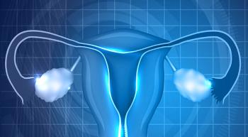 ovarian cancer