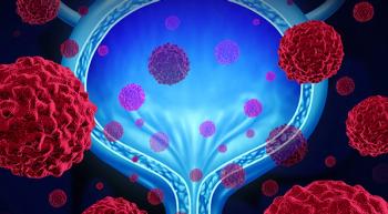 Image of a bladder surrounded by cancer cells.