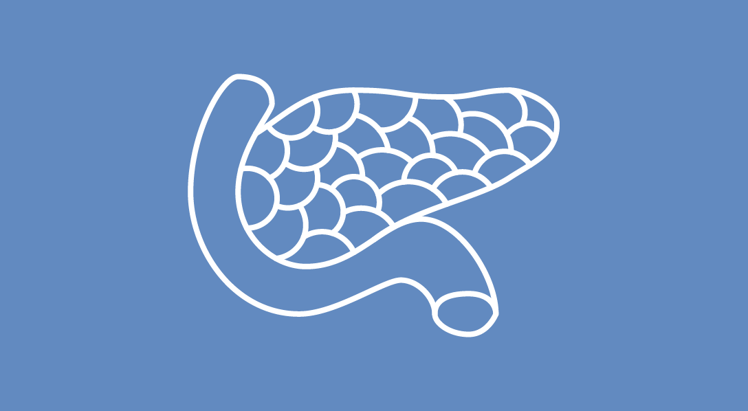 Pancreatic cancer