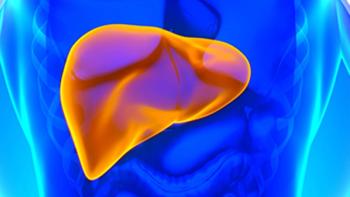 hepatocellular carcinoma 