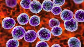Image of lymphoma cells