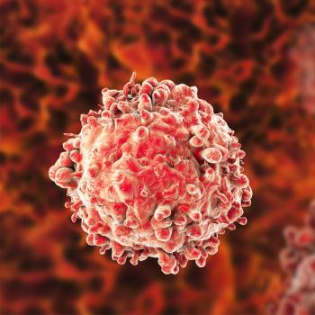Image of an abnormal white blood cell