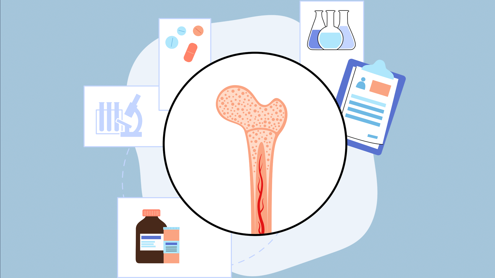 Caring for an Immunocompromised Bone Marrow Transplant Recipient