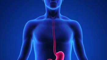 Diagram of a person with esophagus and upper gastrointestinal tract highlighted in pinl