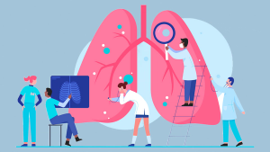 Illustration of clinicians investigating a large illustrated lung