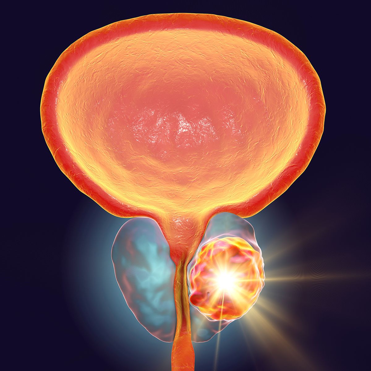 The FDA's ODAC voted unanimously against the risk-benefit profile of talazoparib and enzalutamide for the treatment of mCRPC: © stock.adobe.com.