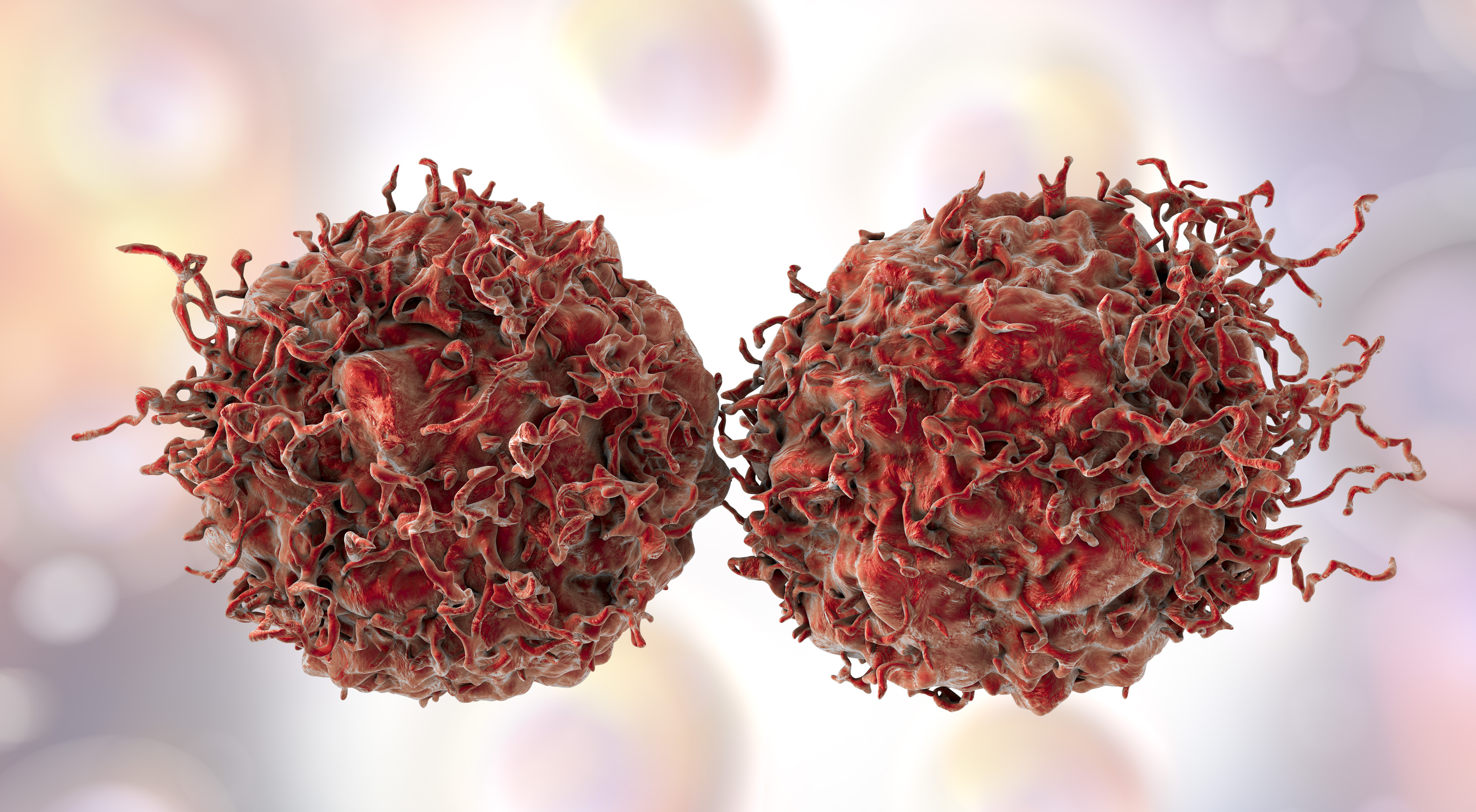 Regardless of Prior Local Treatment, Patients With mHSPC Achieve Improved Long-Term Survival With Enzalutamide Plus ADT