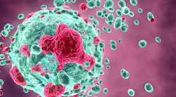 TIL Therapy Outperforms Ipilimumab in Extending Progression-Free Survival in Unresectable Melanoma