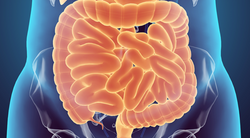 Neoadjuvant Nivolumab/Ipilimumab Yields 95% Major Pathological Response Rate in dMMR Colon Cancer