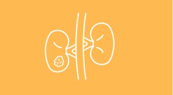 Kidney Cancer