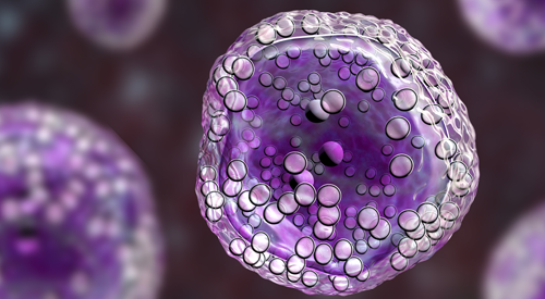 Image of a lymphoma cell