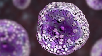 Image of a lymphoma cell
