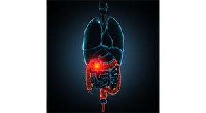 Nurses Can Refer Patients to Reliable Stomach Cancer Information