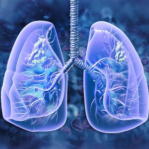 Graphic of lungs with tumors