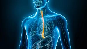 Graphic of a person's esophagus