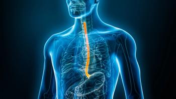 Graphic of a person's esophagus