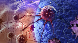 Tislelizumab Rivals Sorafenib in Improving OS in Unresectable Hepatocellular Carcinoma