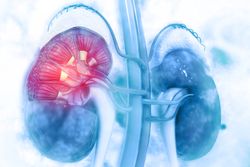 Cabozantinib Associated With Higher Rates of Certain AEs in Advanced Kidney Cancer