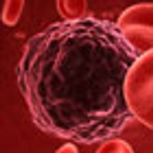 Cancer Deaths Continue to Decline, Report Says