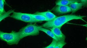 Expert Talks Pembrolizumab for TMB-High Tumors