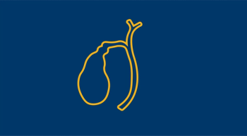 Cholangiocarcinoma