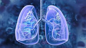 Graphic of lungs with a tumor