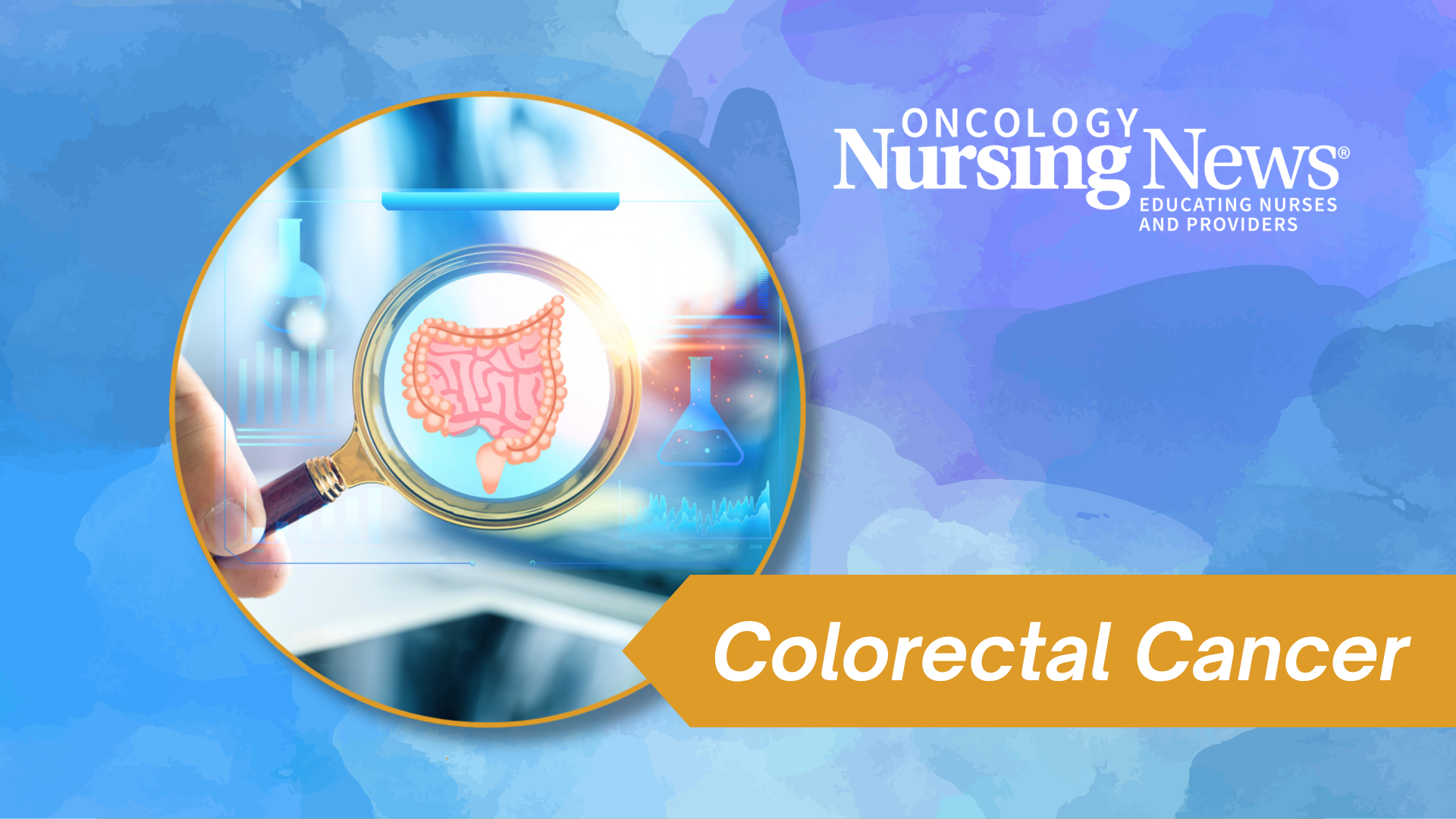 <![CDATA[Integrating Lifestyle Interventions and Molecular Profiling into Early-Stage CRC Care]]>