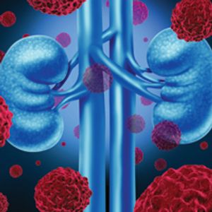 Using Antibiotics Could Affect Checkpoint Inhibitors