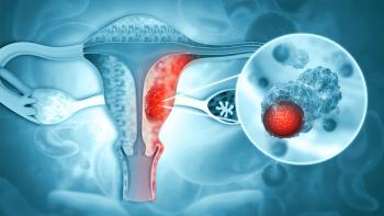 Diagram of endometrial cancer