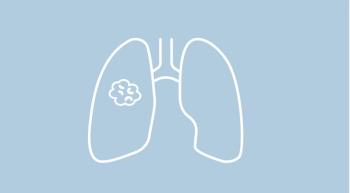 lung cancer
