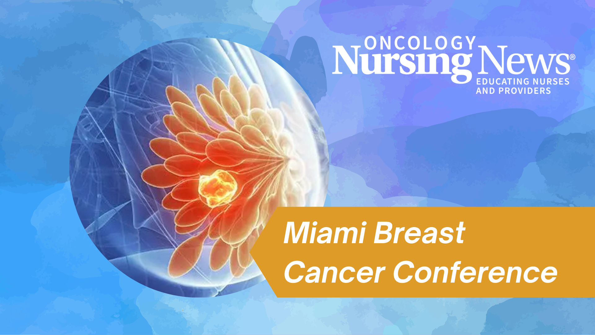 SLNB Omission is Growing in Older Patients With Early-Stage Breast ...
