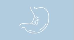 Benefit-Risk Profile of Trastuzumab/Pertuzumab With FLOT Regimen Comes Into Question in HER2-positive Gastric Cancer