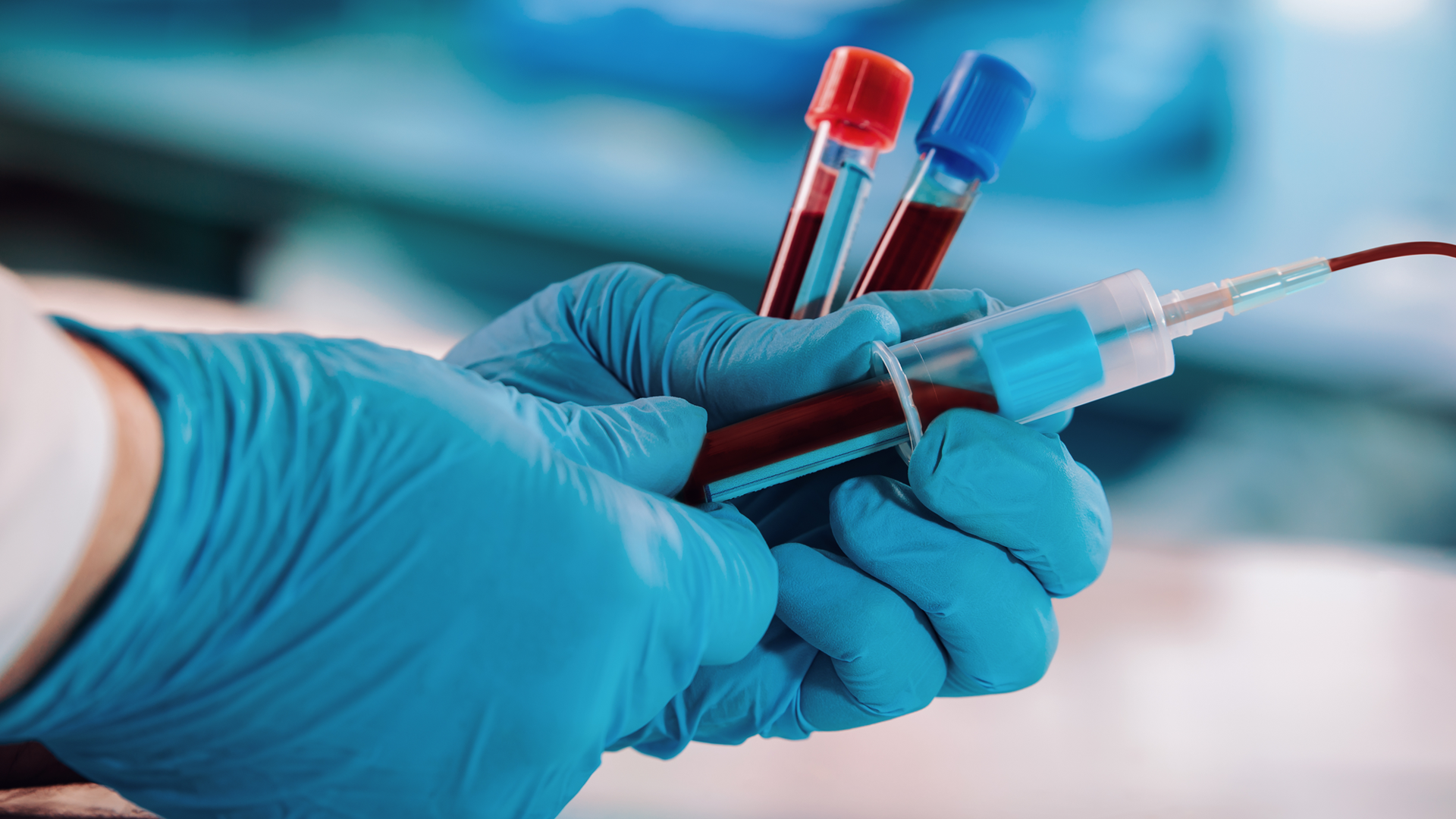 Repeated Hematologic Evaluations May Not be Necessary for Patients Receiving ICIs