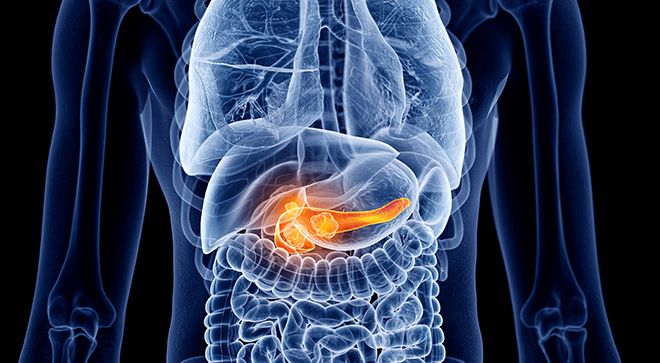 pancreatic ductal adenocarcinoma