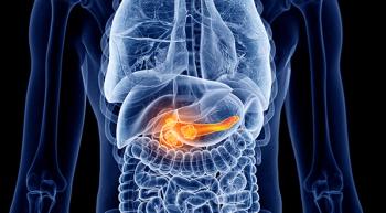 pancreatic ductal adenocarcinoma